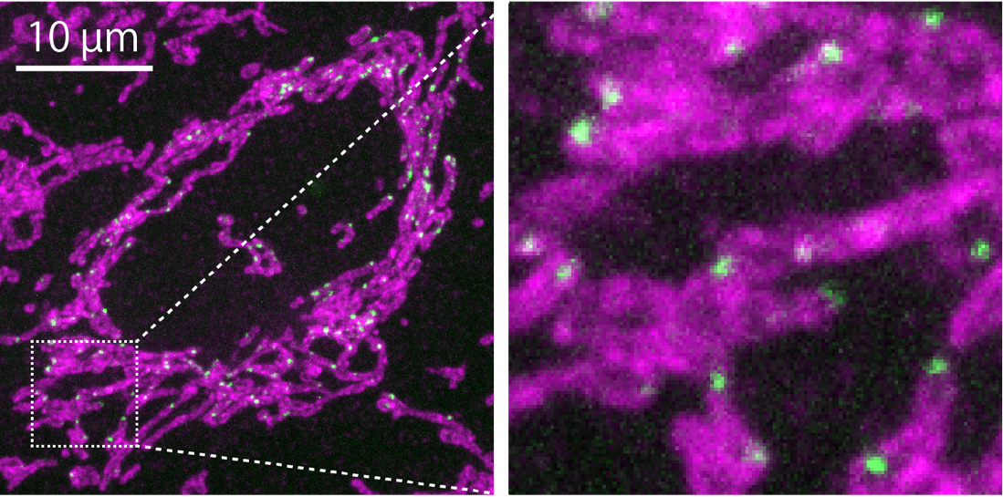 ヒト培養細胞におけるミトコンドリア（赤紫色）と，今回開発した手法で可視化したミトコンドリア-小胞体間コンタクトサイト（緑色）